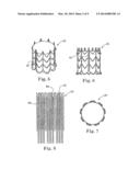 STENTS FOR PROSTHETIC HEART VALVES diagram and image