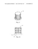 STENTS FOR PROSTHETIC HEART VALVES diagram and image