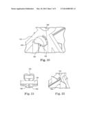 STENTS FOR PROSTHETIC HEART VALVES diagram and image