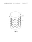 STENTS FOR PROSTHETIC HEART VALVES diagram and image