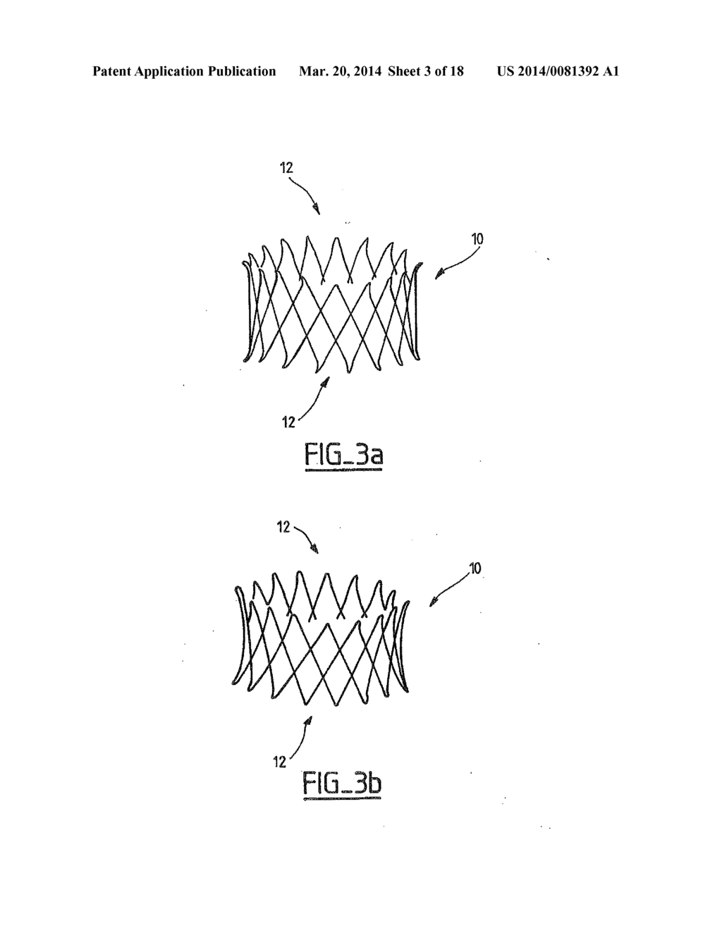 COLLAPSIBLE PROSTHETIC VALVE HAVING AN INTERNAL COVER - diagram, schematic, and image 04