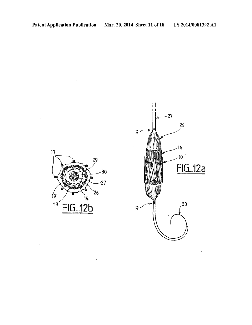 COLLAPSIBLE PROSTHETIC VALVE HAVING AN INTERNAL COVER - diagram, schematic, and image 12