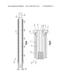 NESTED EXPANDABLE SLEEVE IMPLANT diagram and image