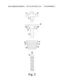 FEMORAL KNEE PROSTHESIS SYSTEM WITH AUGMENTS AND MULTIPLE LENGTHS OF     SLEEVES SHARING A COMMON GEOMETRY diagram and image