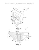 FEMORAL KNEE PROSTHESIS SYSTEM WITH AUGMENTS AND MULTIPLE LENGTHS OF     SLEEVES SHARING A COMMON GEOMETRY diagram and image