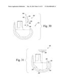 FEMORAL KNEE PROSTHESIS SYSTEM WITH AUGMENTS AND MULTIPLE LENGTHS OF     SLEEVES SHARING A COMMON GEOMETRY diagram and image