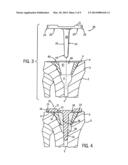 PROSTHETIC IMPLANT SUPPORT STRUCTURE diagram and image