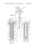 PROSTHETIC IMPLANT SUPPORT STRUCTURE diagram and image