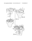 PROSTHETIC IMPLANT SUPPORT STRUCTURE diagram and image