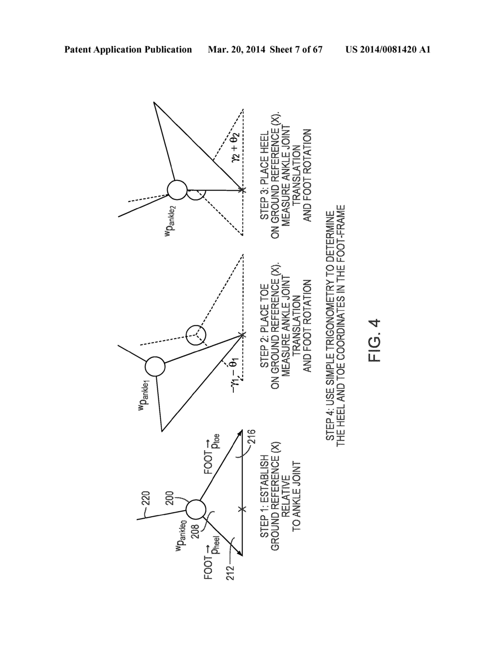 IMPLEMENTING A STAND-UP SEQUENCE USING A LOWER-EXTREMITY PROSTHESIS OR     ORTHOSIS - diagram, schematic, and image 08