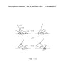 IMPLEMENTING A STAND-UP SEQUENCE USING A LOWER-EXTREMITY PROSTHESIS OR     ORTHOSIS diagram and image