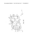 IMPLEMENTING A STAND-UP SEQUENCE USING A LOWER-EXTREMITY PROSTHESIS OR     ORTHOSIS diagram and image