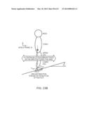 IMPLEMENTING A STAND-UP SEQUENCE USING A LOWER-EXTREMITY PROSTHESIS OR     ORTHOSIS diagram and image