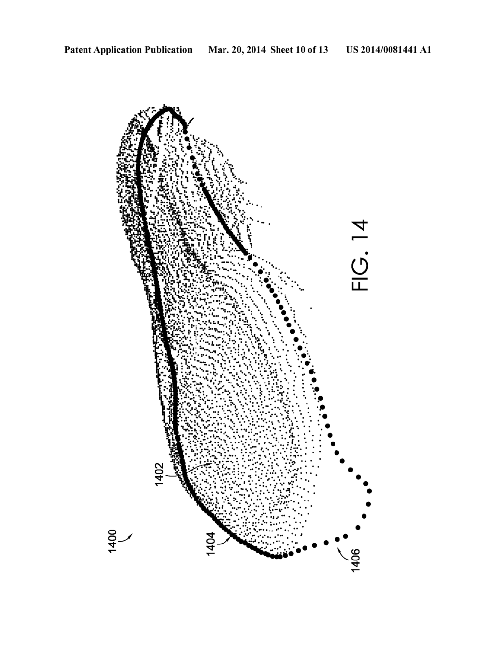 Generation Of Tool Paths For Shoe Assembly - diagram, schematic, and image 11