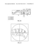 SYSTEMS AND METHODS FOR SURGICAL AND INTERVENTIONAL PLANNING, SUPPORT,     POST-OPERATIVE FOLLOW-UP, AND FUNCTIONAL RECOVERY TRACKING diagram and image