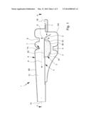 VIBRATING BLISTER diagram and image