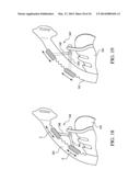 PATIENT INTERFACE WITH AN ADJUSTABLE CUSHION diagram and image