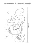 PATIENT INTERFACE WITH AN ADJUSTABLE CUSHION diagram and image