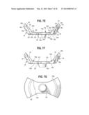 FLUID END OF A HIGH PRESSURE PUMP HAVING A GROOVE ADAPTED TO RECEIVE A     SPRING RETAINER OF A SUCTION VALVE diagram and image