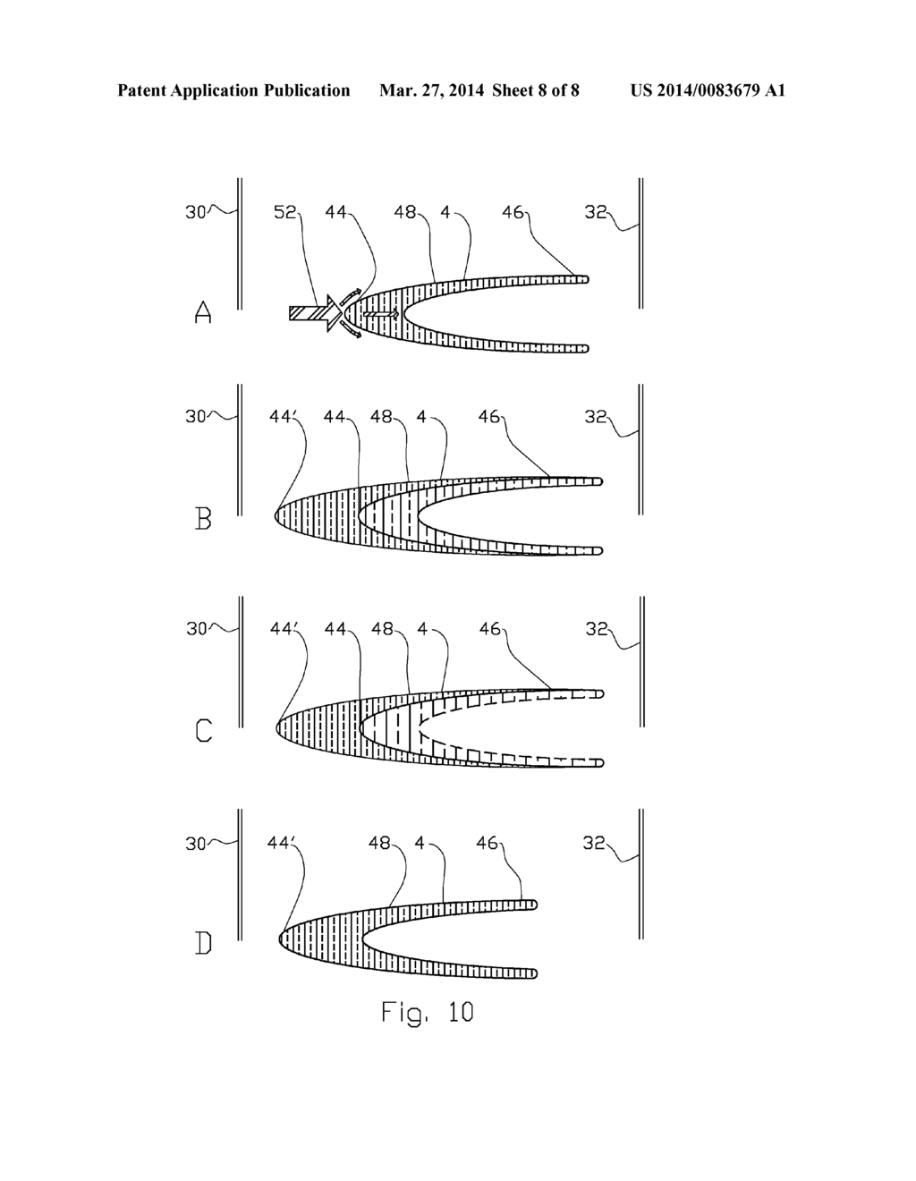 METHOD FOR MICROBIAL CONTROL OF INJECTION LIQUID FLOW IN A HYDROCARBON     RESERVOIR - diagram, schematic, and image 09