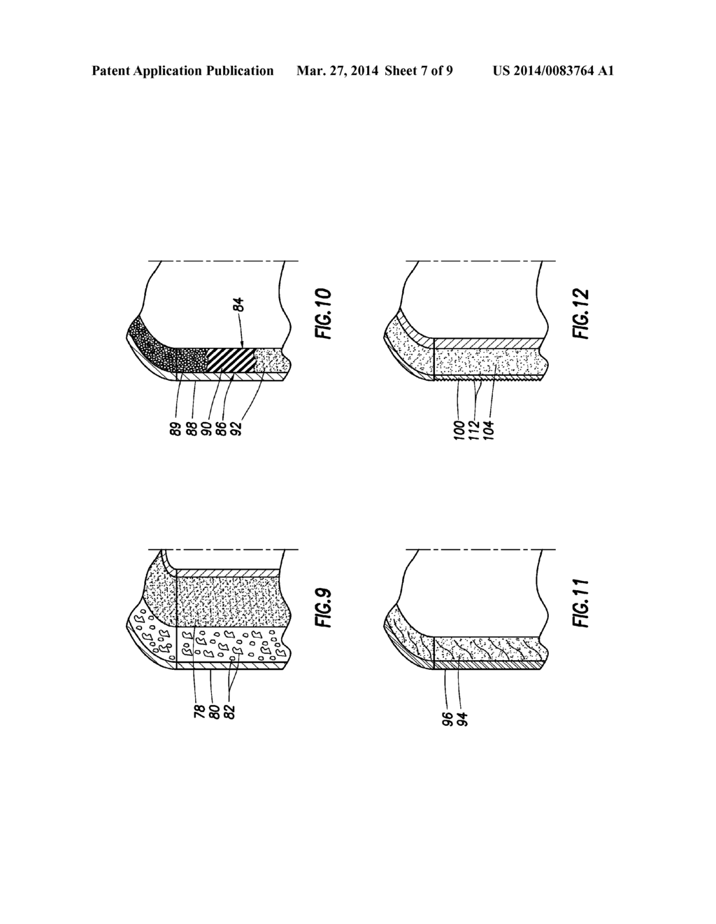 METHOD AND APPARATUS FOR EXPENDABLE TUBING-CONVEYED PERFORATING GUN - diagram, schematic, and image 08