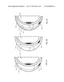 ASSEMBLING THIN SILICON CHIPS ON A CONTACT LENS diagram and image