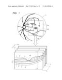 OPHTHALMIC DIAGNOSIS SUPPORT APPARATUS AND OPHTHALMIC DIAGNOSIS SUPPORT     METHOD diagram and image