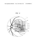 OPHTHALMIC DIAGNOSIS SUPPORT APPARATUS AND OPHTHALMIC DIAGNOSIS SUPPORT     METHOD diagram and image