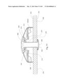 RING BINDER MECHANISM diagram and image