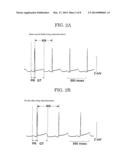 PIG FOR ATRIOVENTRICULAR BLOCK MODEL, MONKEY FOR ATRIOVENTRICULAR BLOCK     MODEL, GUINEA PIG FOR ATRIOVENTRICULAR BLOCK MODEL, AND USE THEREOF diagram and image