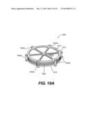 LEAD-ACID BATTERY DESIGN HAVING VERSATILE FORM FACTOR diagram and image