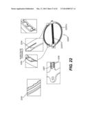 LEAD-ACID BATTERY DESIGN HAVING VERSATILE FORM FACTOR diagram and image