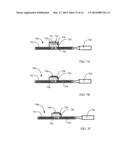 APPARATUS AND METHOD FOR DENTAL IMPLANT FIXTURE LOCATION DETERMINATION diagram and image