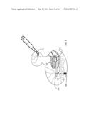 APPARATUS AND METHOD FOR DENTAL IMPLANT FIXTURE LOCATION DETERMINATION diagram and image