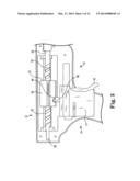 TOOLS AND METHODS FOR TREATMENT OF PELVIC CONDITIONS diagram and image