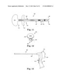 TOOLS AND METHODS FOR TREATMENT OF PELVIC CONDITIONS diagram and image