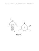 TOOLS AND METHODS FOR TREATMENT OF PELVIC CONDITIONS diagram and image