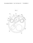 Endoscope diagram and image