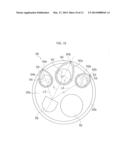 Endoscope diagram and image