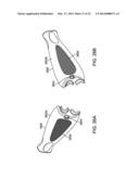 ILLUMINATED SUCTION APPARATUS diagram and image