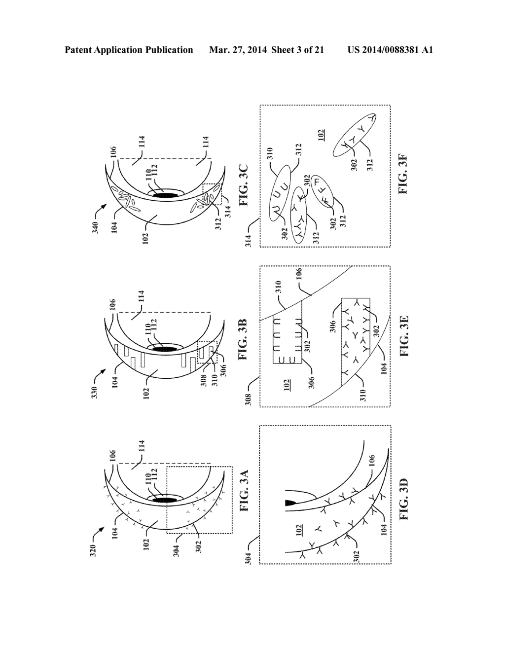 FACILITATION OF TEAR SAMPLE COLLECTION AND TESTING USING A CONTACT LENS - diagram, schematic, and image 04