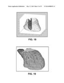 PHYSIOLOGICAL MAPPING FOR ARRHYTHMIA diagram and image