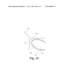 METHOD FOR PUNCTURING THE PERICARDIAL MEMBRANE BY SYNCHRONIZING NEEDLE     ADVANCEMENT WITH CARDIAC MUSCLE MOTION diagram and image