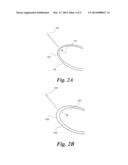 METHOD FOR PUNCTURING THE PERICARDIAL MEMBRANE BY SYNCHRONIZING NEEDLE     ADVANCEMENT WITH CARDIAC MUSCLE MOTION diagram and image