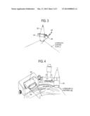 ROBOTIC LOCALIZING AID FOR HIGH INTENSITY FOCUSED ULTRASOUND DELIVERY diagram and image