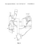 ROBOTIC LOCALIZING AID FOR HIGH INTENSITY FOCUSED ULTRASOUND DELIVERY diagram and image