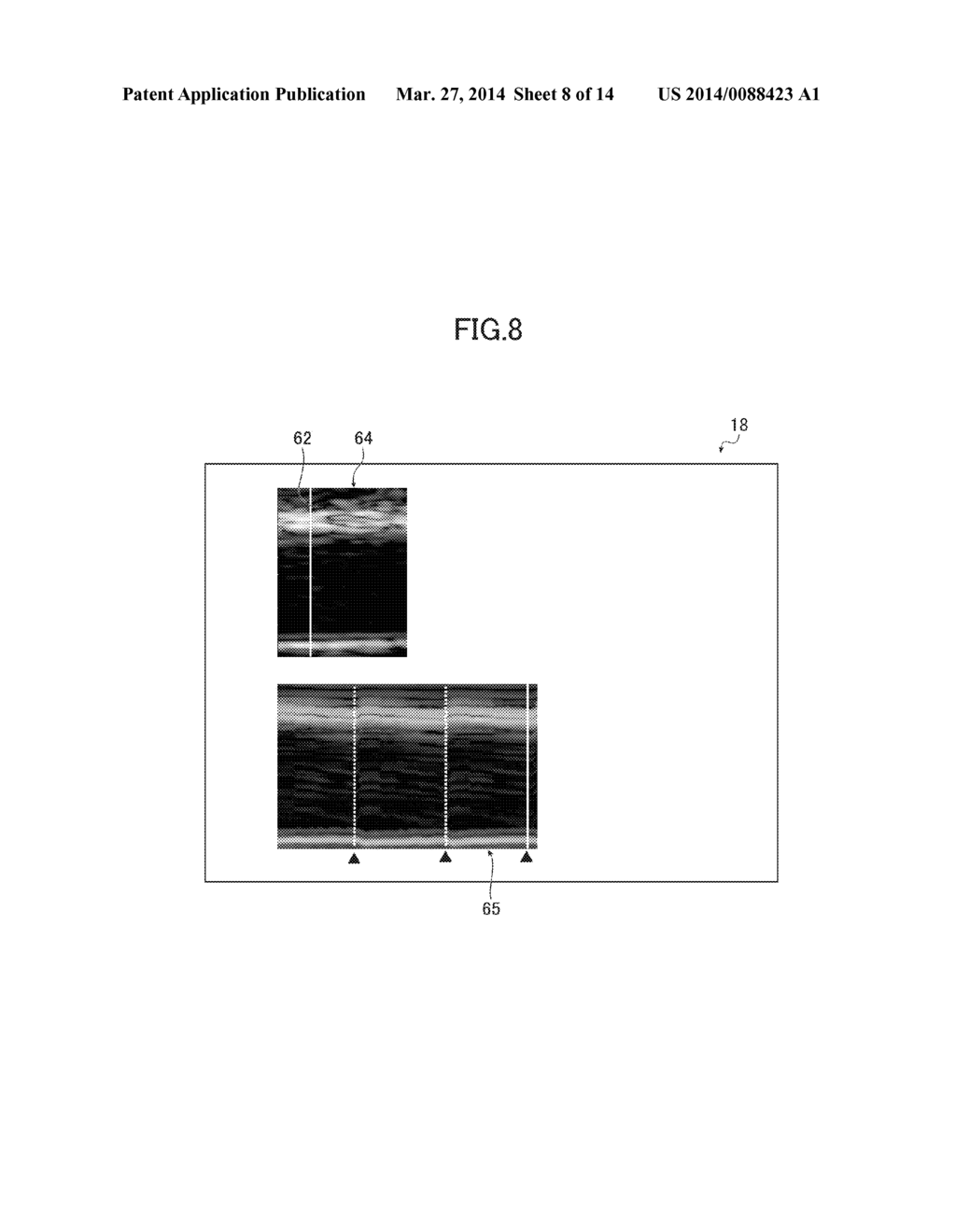 ULTRASOUND DIAGNOSTIC APPARATUS - diagram, schematic, and image 09