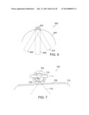 ULTRASOUND IMAGING SYSTEM AND METHOD diagram and image