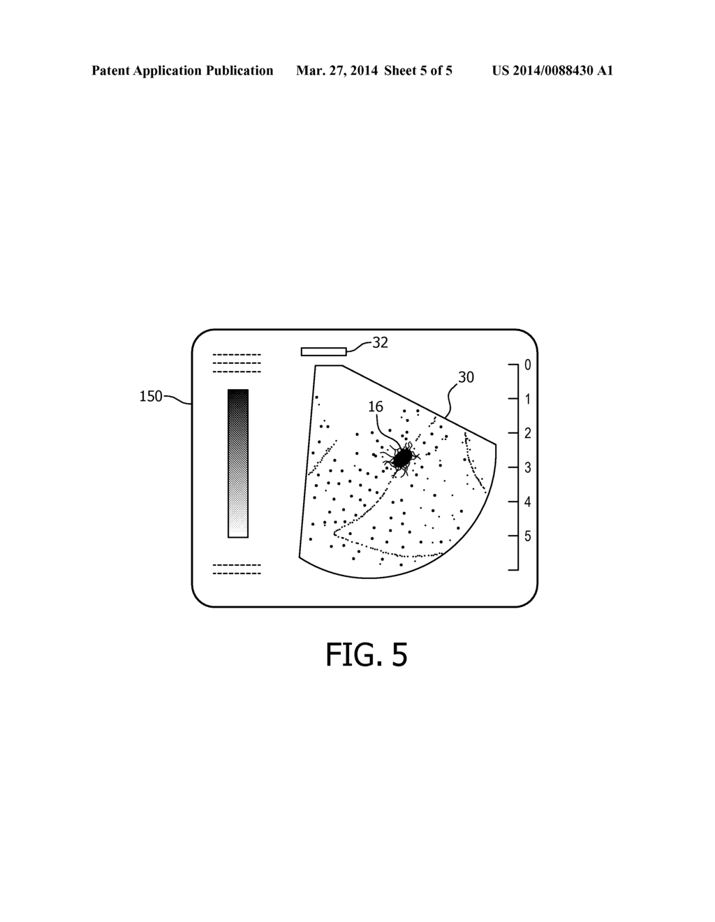 ULTRASONIC IMAGE GUIDANCE OF TRANSCUTANEOUS PROCEDURES - diagram, schematic, and image 06