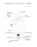 TYMPANIC PROBE COVER diagram and image